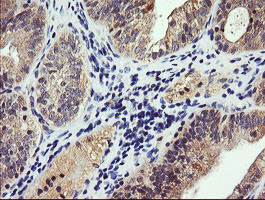 PIK3CG Antibody in Immunohistochemistry (Paraffin) (IHC (P))