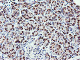 PIK3CG Antibody in Immunohistochemistry (Paraffin) (IHC (P))