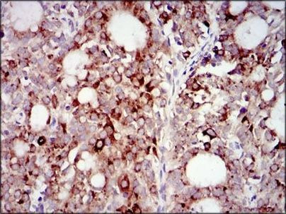 PI3K p85 alpha Antibody in Immunohistochemistry (Paraffin) (IHC (P))