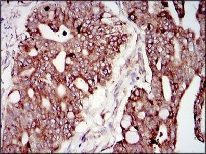 PI3K p85 alpha Antibody in Immunohistochemistry (Paraffin) (IHC (P))