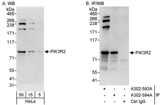 PIK3R2 Antibody in Western Blot (WB)