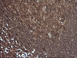 PIK3R5 Antibody in Immunohistochemistry (Paraffin) (IHC (P))