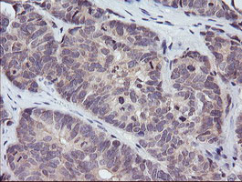 PIK3R5 Antibody in Immunohistochemistry (Paraffin) (IHC (P))