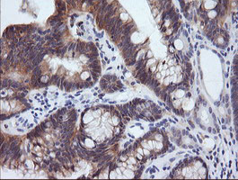 PIK3R5 Antibody in Immunohistochemistry (Paraffin) (IHC (P))