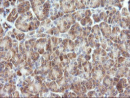 PIK3R5 Antibody in Immunohistochemistry (Paraffin) (IHC (P))