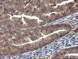 PIK3R5 Antibody in Immunohistochemistry (Paraffin) (IHC (P))