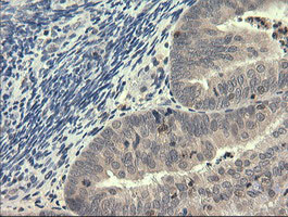 PIK3R5 Antibody in Immunohistochemistry (Paraffin) (IHC (P))