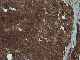 PIK3R5 Antibody in Immunohistochemistry (Paraffin) (IHC (P))