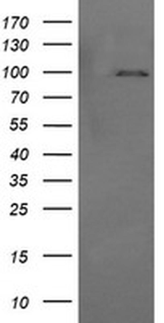 PIK3R5 Antibody in Western Blot (WB)