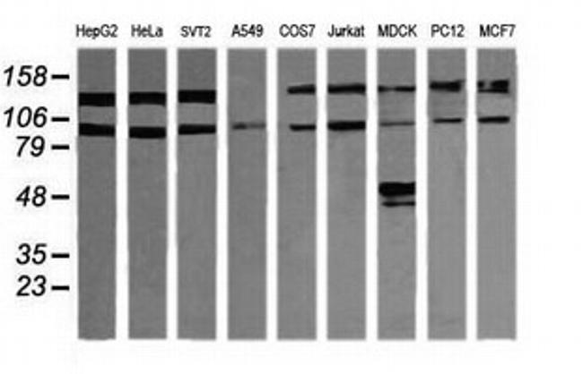 PIK3R5 Antibody in Western Blot (WB)