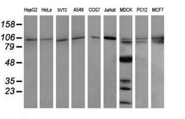 PIK3R5 Antibody in Western Blot (WB)