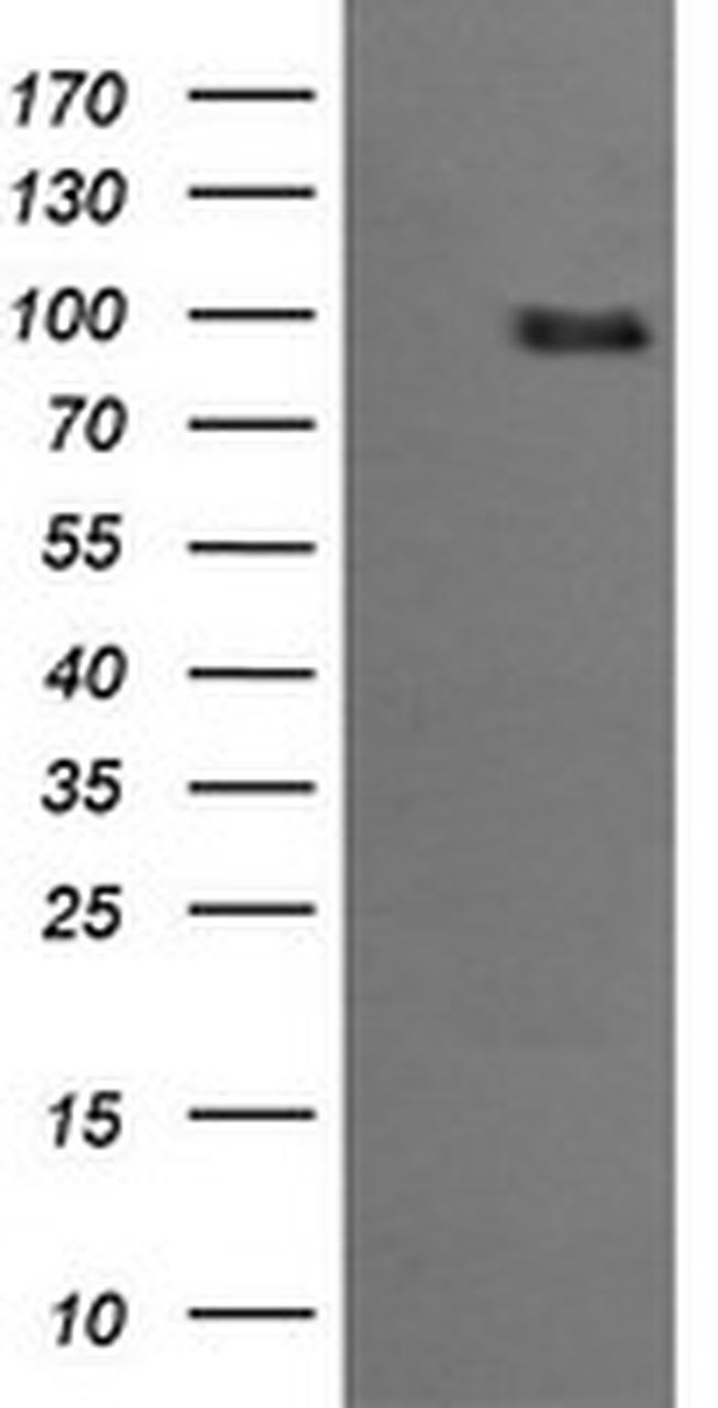 PIK3R5 Antibody in Western Blot (WB)