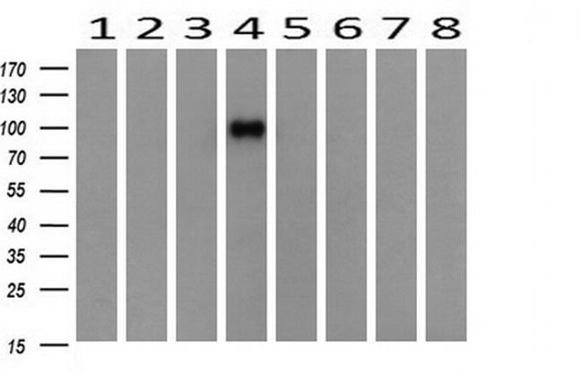 PIK3R5 Antibody in Western Blot (WB)