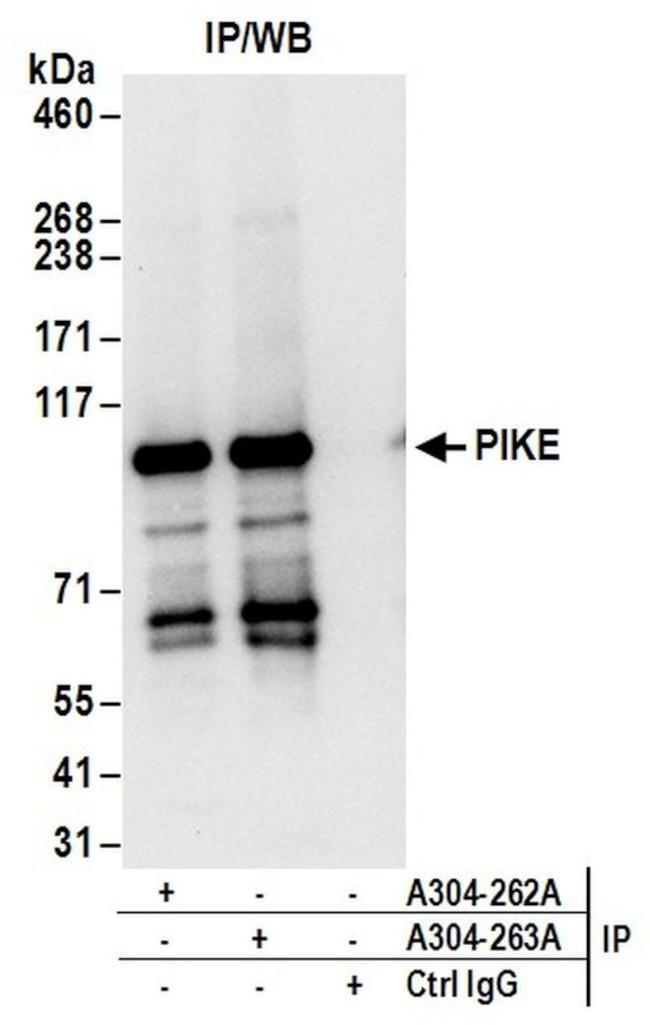 PIKE Antibody in Immunoprecipitation (IP)