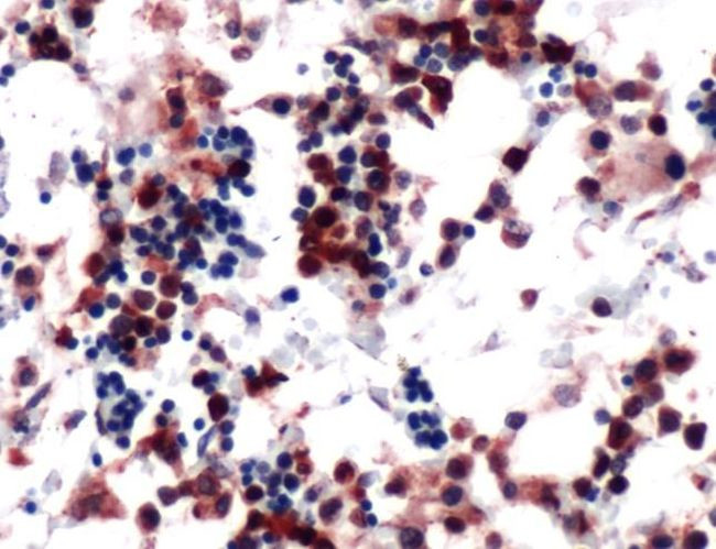 PIM1 Antibody in Immunohistochemistry (IHC)