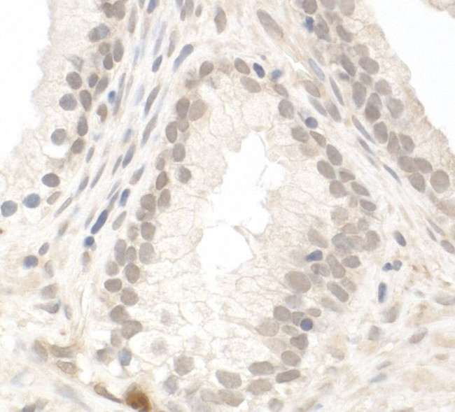 PIMT Antibody in Immunohistochemistry (IHC)