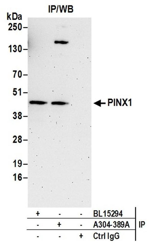 PINX1 Antibody in Western Blot (WB)