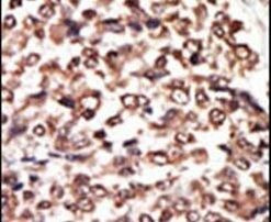 PRKD3 Antibody in Immunohistochemistry (IHC)