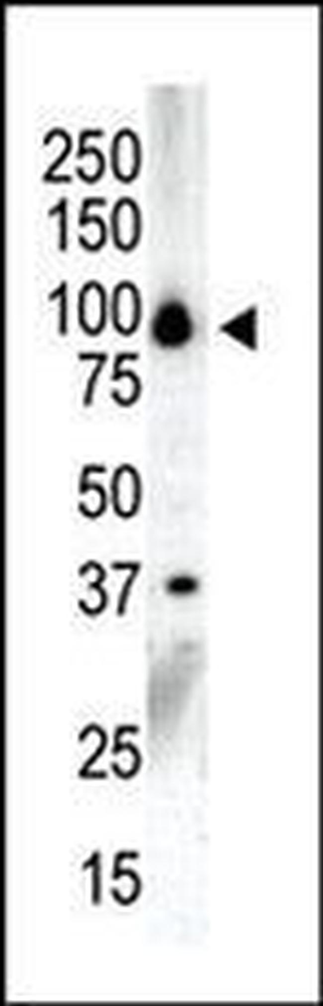 PRKD3 Antibody in Western Blot (WB)