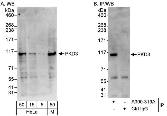 PKD3 Antibody in Western Blot (WB)