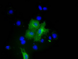 PKLR Antibody in Immunocytochemistry (ICC/IF)