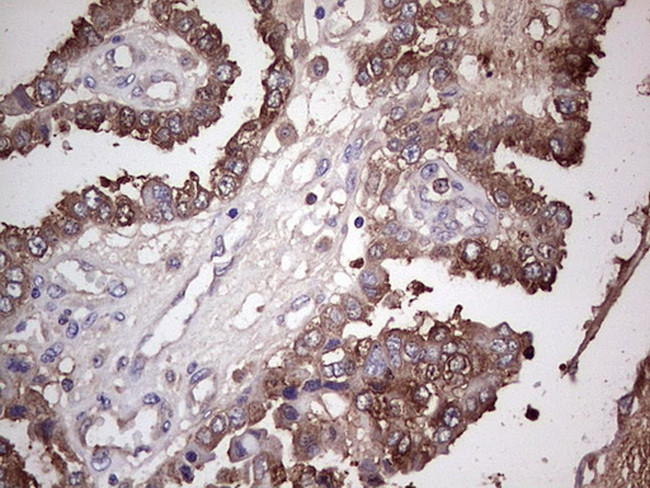 PKM2 Antibody in Immunohistochemistry (Paraffin) (IHC (P))