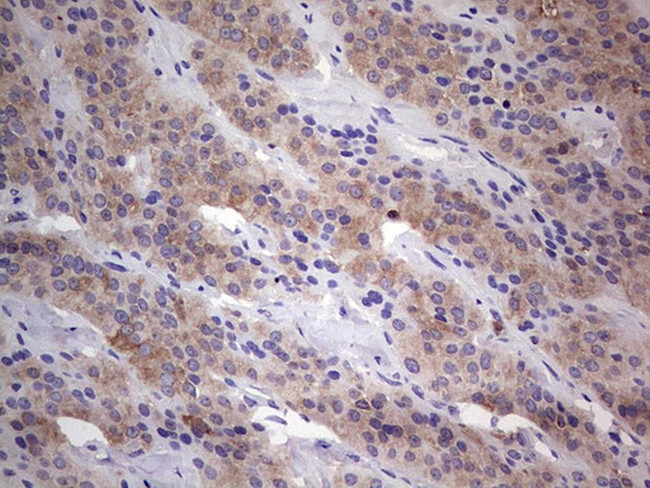 PKM2 Antibody in Immunohistochemistry (Paraffin) (IHC (P))