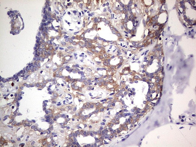 PKM2 Antibody in Immunohistochemistry (Paraffin) (IHC (P))