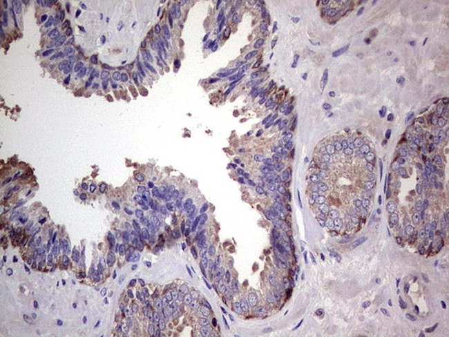 PKM2 Antibody in Immunohistochemistry (Paraffin) (IHC (P))