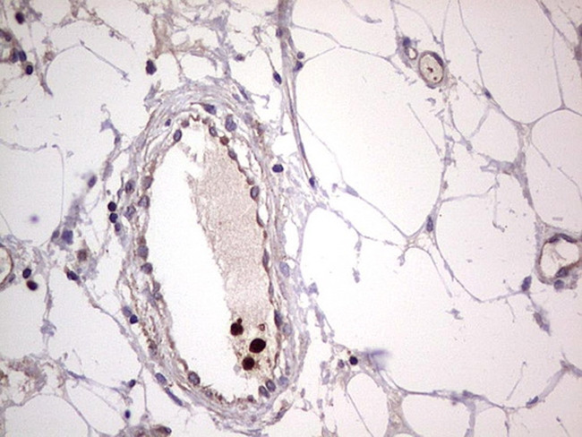 PKM2 Antibody in Immunohistochemistry (Paraffin) (IHC (P))