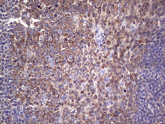 PKM2 Antibody in Immunohistochemistry (Paraffin) (IHC (P))