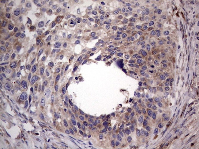 PKM2 Antibody in Immunohistochemistry (Paraffin) (IHC (P))