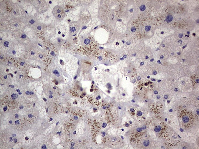 PKM2 Antibody in Immunohistochemistry (Paraffin) (IHC (P))