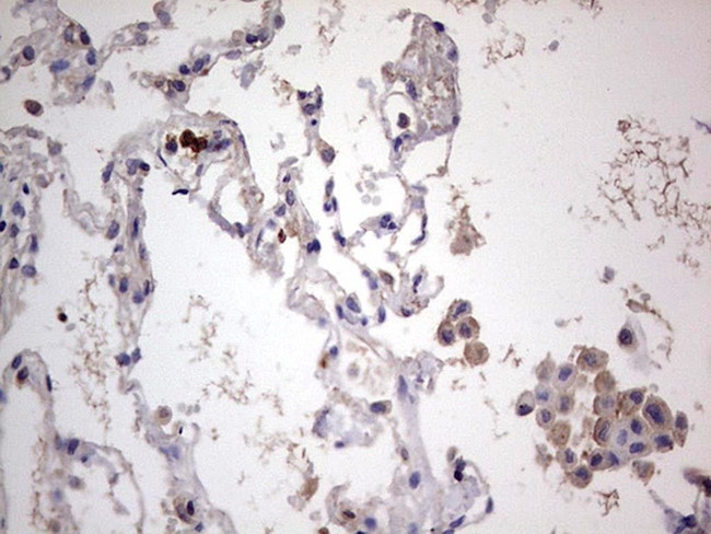 PKM2 Antibody in Immunohistochemistry (Paraffin) (IHC (P))