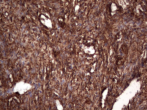 PKM2 Antibody in Immunohistochemistry (Paraffin) (IHC (P))