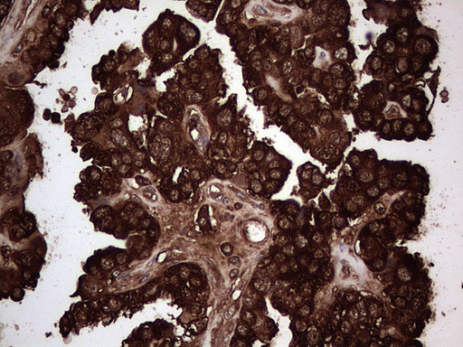 PKM2 Antibody in Immunohistochemistry (Paraffin) (IHC (P))