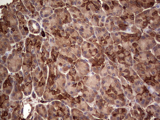 PKM2 Antibody in Immunohistochemistry (Paraffin) (IHC (P))