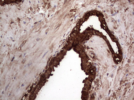 PKM2 Antibody in Immunohistochemistry (Paraffin) (IHC (P))