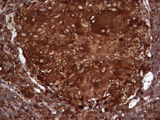 PKM2 Antibody in Immunohistochemistry (Paraffin) (IHC (P))