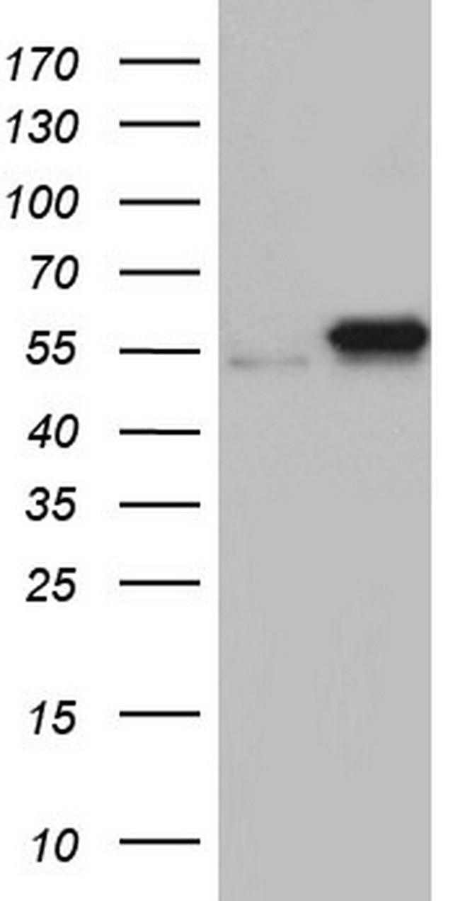 PKM2 Antibody in Western Blot (WB)