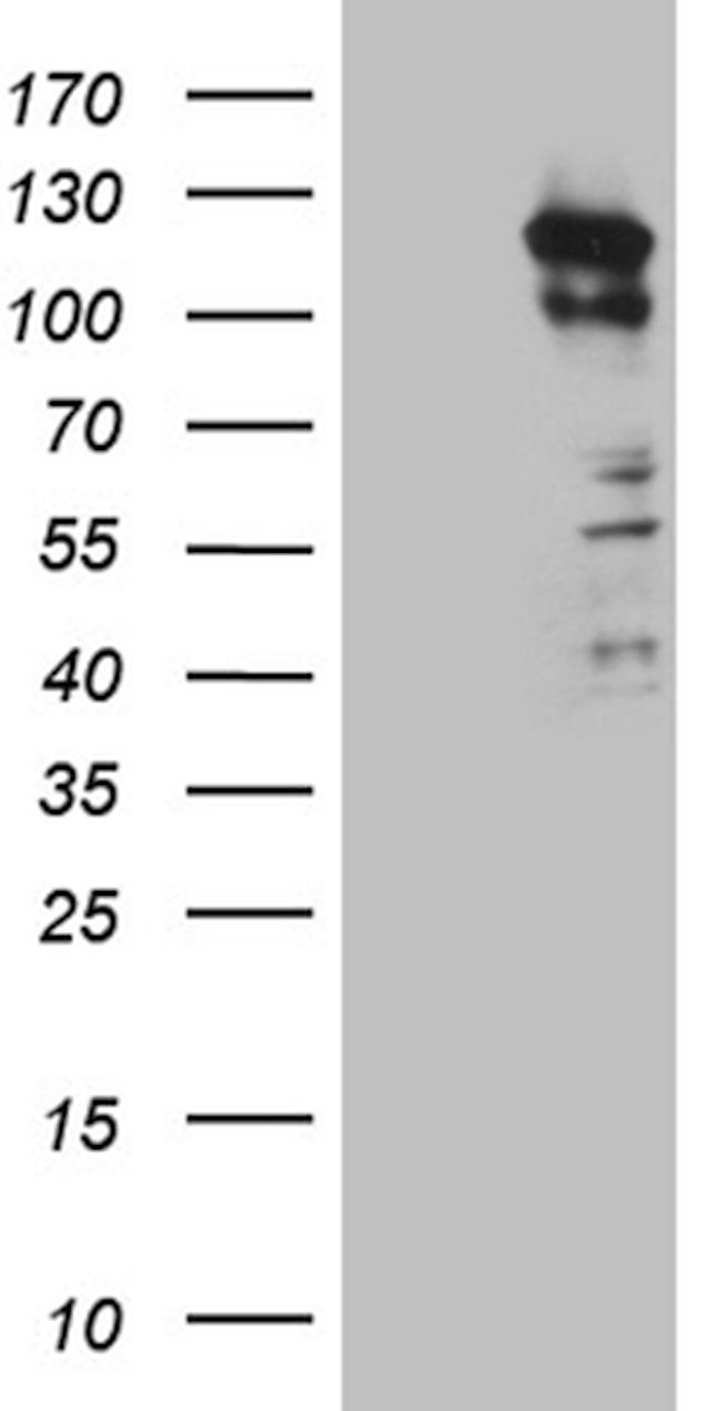 PKN3 Antibody in Western Blot (WB)