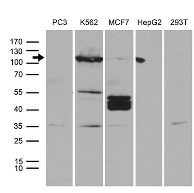 PKN3 Antibody in Western Blot (WB)