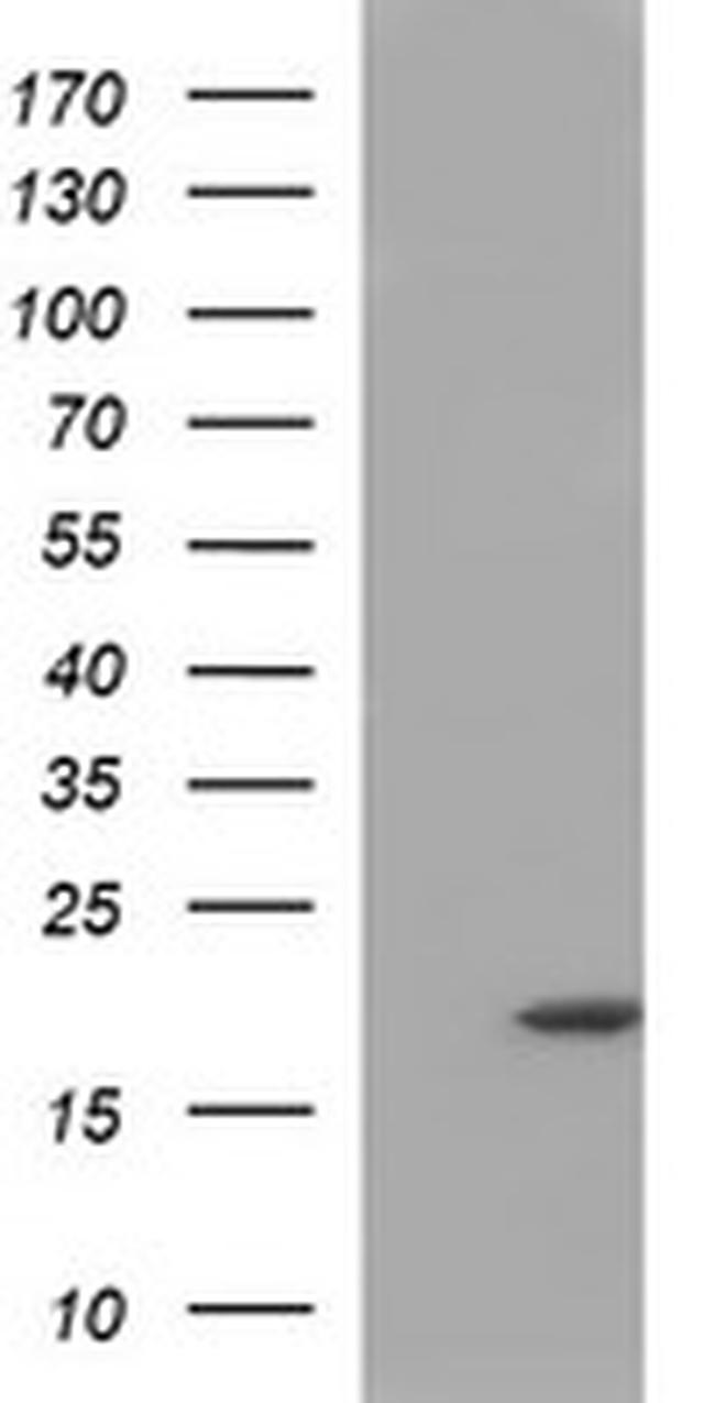 PLA2G16 Antibody in Western Blot (WB)