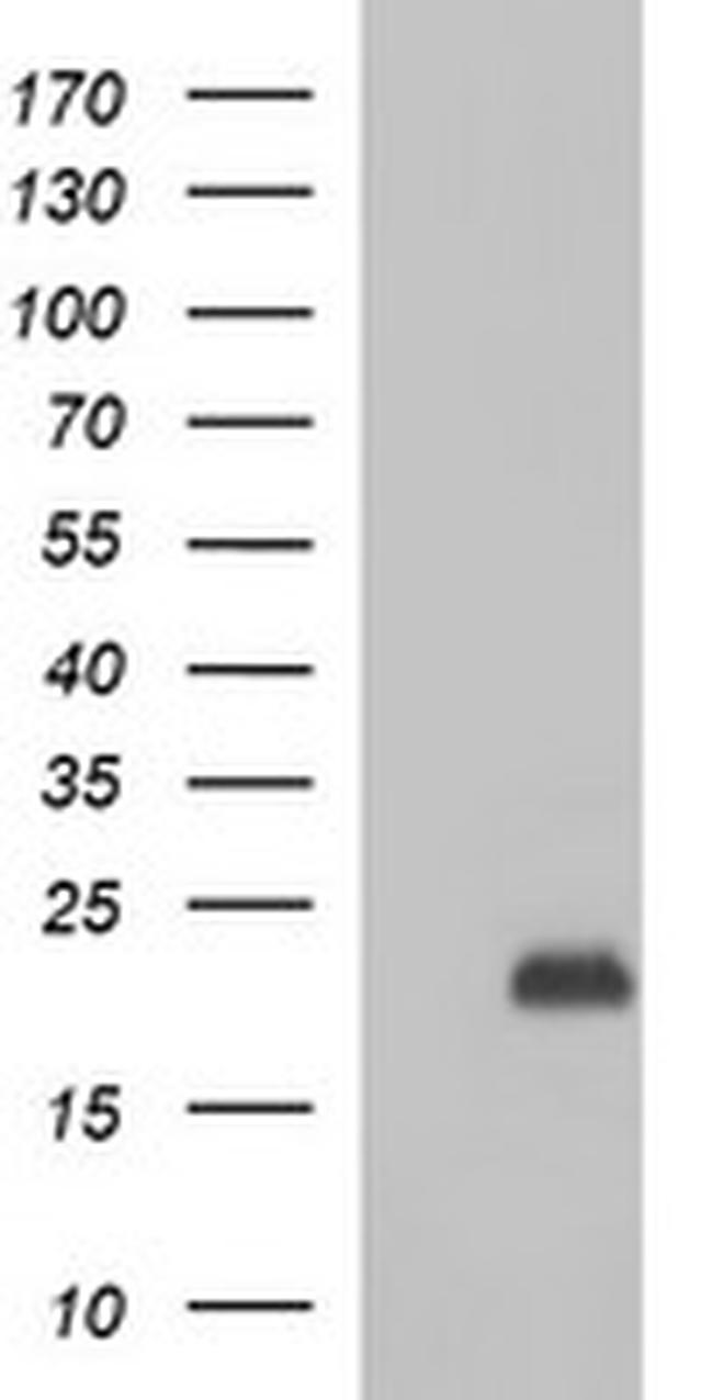 PLA2G16 Antibody in Western Blot (WB)