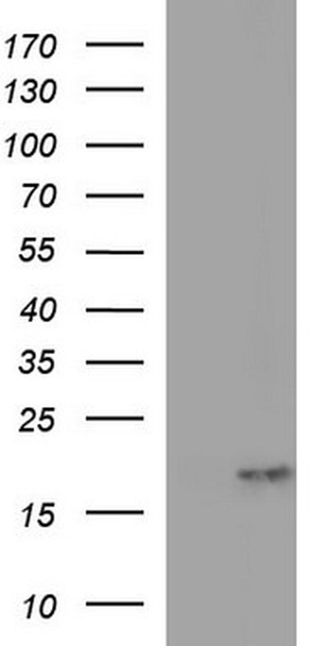 PLA2G16 Antibody in Western Blot (WB)