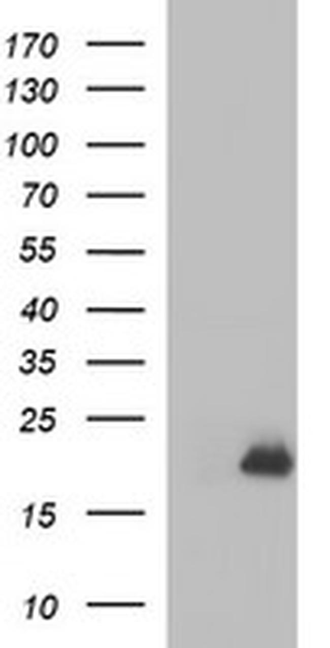 PLA2G16 Antibody in Western Blot (WB)