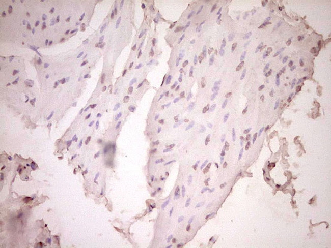 PLAT Antibody in Immunohistochemistry (Paraffin) (IHC (P))