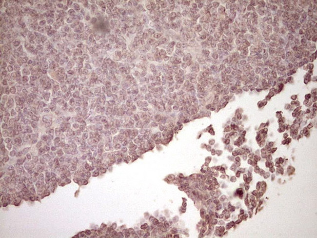 PLAT Antibody in Immunohistochemistry (Paraffin) (IHC (P))