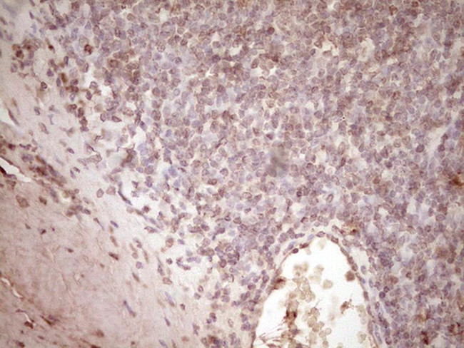 PLAT Antibody in Immunohistochemistry (Paraffin) (IHC (P))