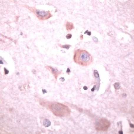 PLCB1 Antibody in Immunohistochemistry (IHC)